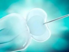 第一代试管婴儿（IVF-ET）